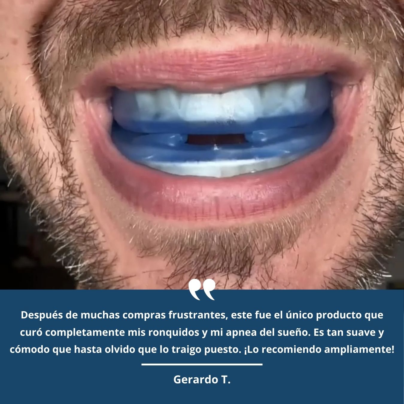 Zenox® Protector Bucal Anti-Ronquidos